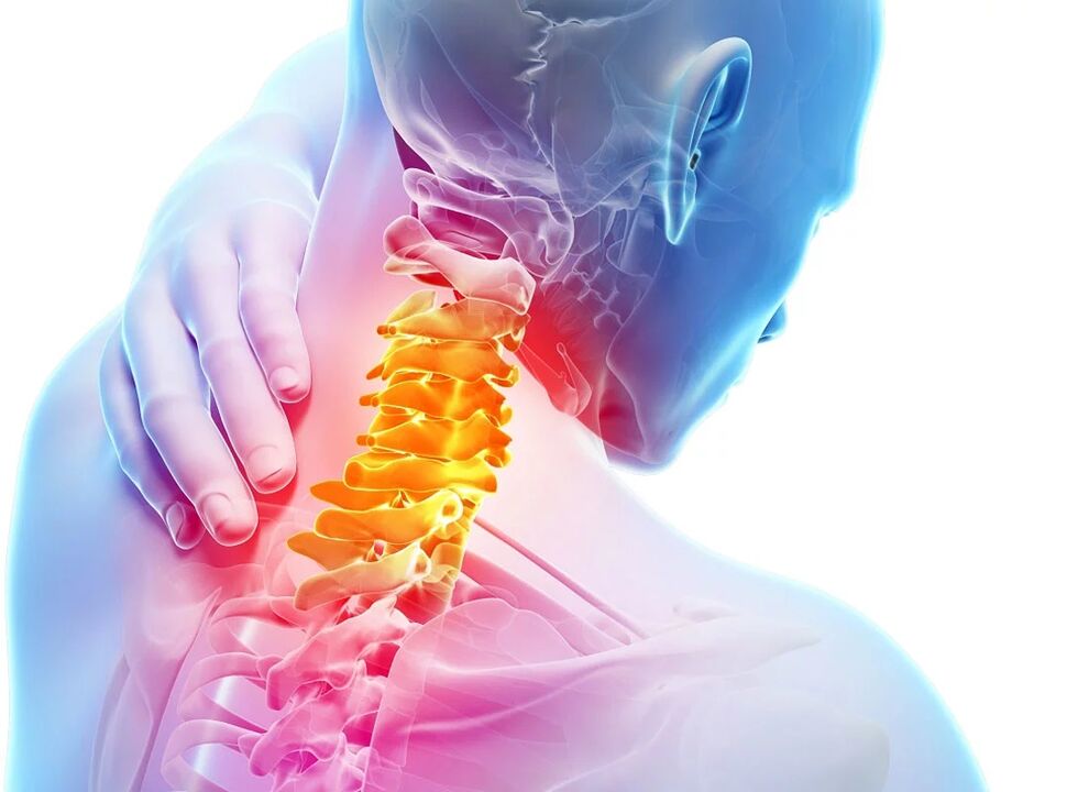 Osteocondrose cervical