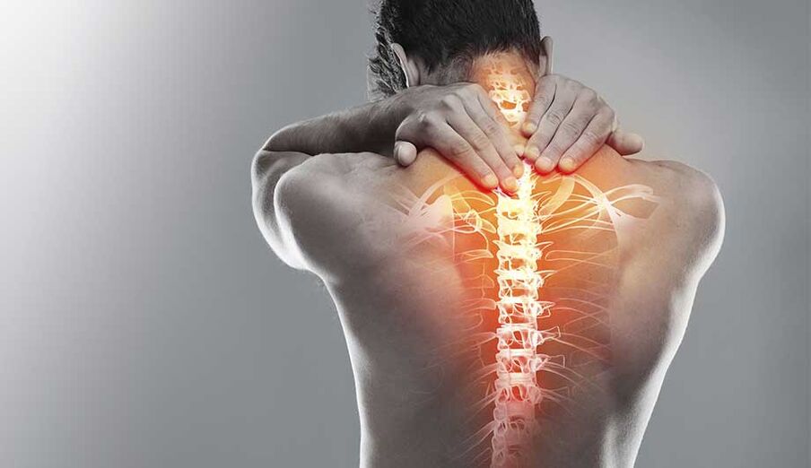 Dor na columna vertebral debido á osteocondrose