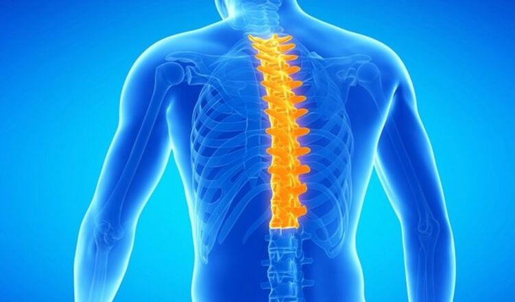 Osteocondrose da columna vertebral torácica