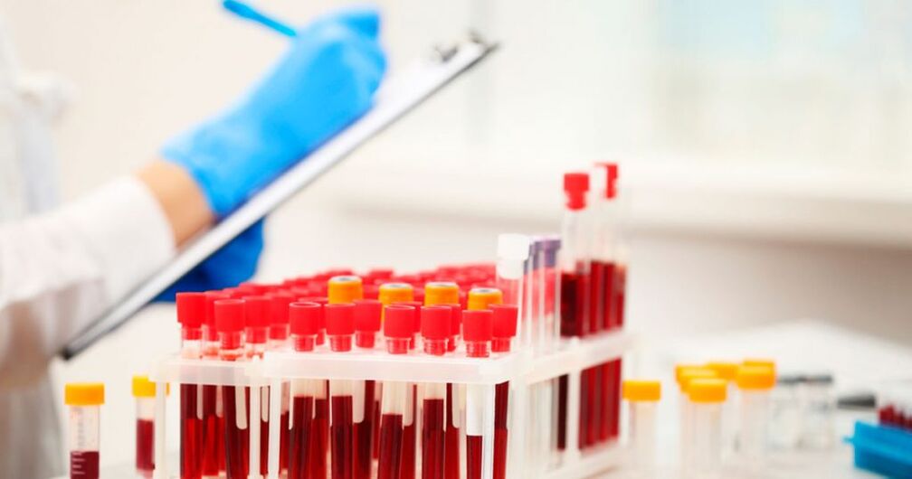 Realizando unha proba de sangue para detectar a inflamación